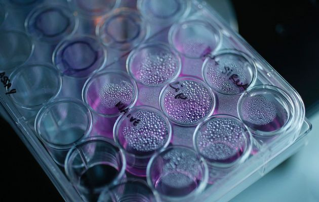 Cum actioneaza tratamentul care dureaza doar o zi si este capabil sa distruga selectiv celulele canceroase!