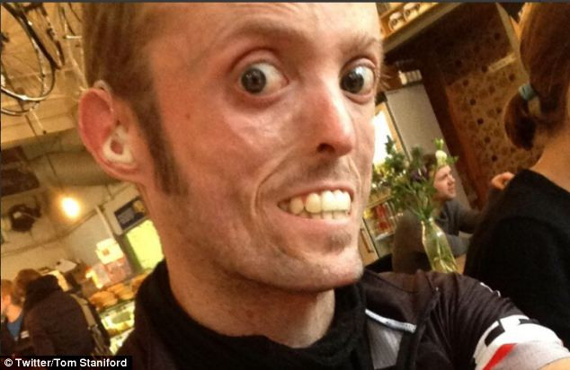 Barbatul care nu se poate ingrasa deloc, oricat ar manca. "Ma usuc vazand cu ochii"