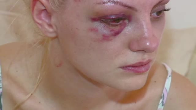 Alexandra Stan, la psiholog si la computerul tomograf. Ranile la cap si la rinichi pot fi serioase