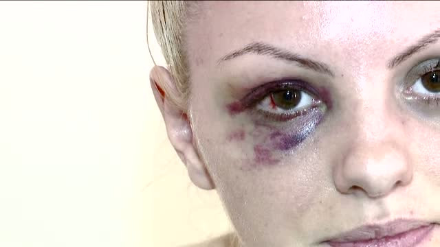 "Va mai dura mult pana cand se va reface." Cand va reveni Alexandra Stan pe scena