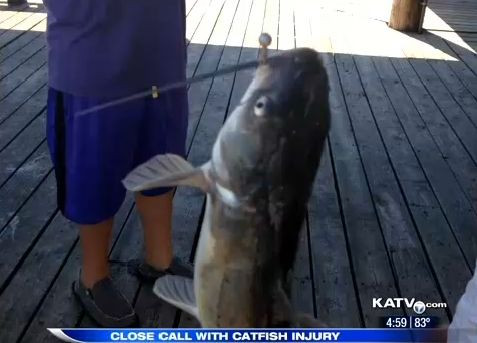 A vrut sa sarute pestele pe care fiul ei l-a prins, dar a fost cea mai mare greseala din viata ei