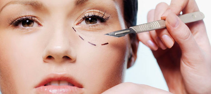 La doar 16 ani a facut prima operatie estetica. Care este motivul si cum arata acum tanara. FOTO