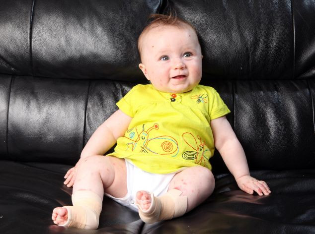 "Ne e frica sa o atingem." Motivul pentru care fetita din imagine nu poate fi imbratisata de parinti