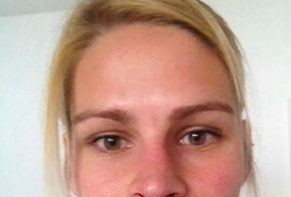 "Ganditi-va mai bine inainte de a face ce am facut eu". Cum arata tanara dupa ce si-a injectat botox