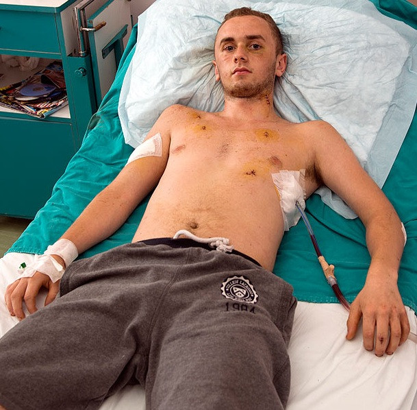 Noi detalii in cazul tanarului englez injunghiat de 17 ori pentru ca a sarutat o fata in Turcia