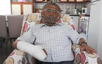 Omul cu masca de fier. Motivul bizar pentru care un barbat si-a inchis capul intr-o "cusca metalica"