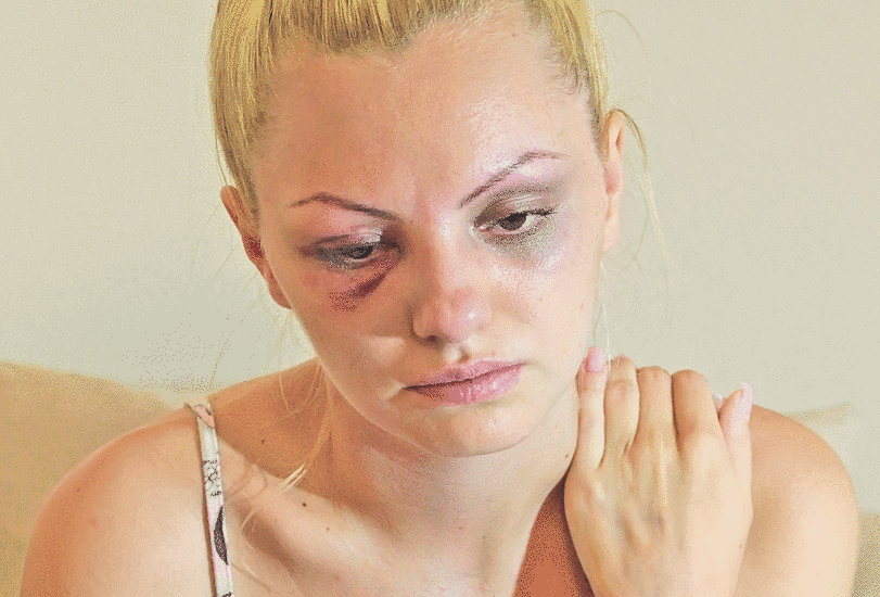 VESTEA TERIBILA pe care Alexandra Stan a primit-o de la medici. "GATA! Nu mai ai voie sa faci asta!"