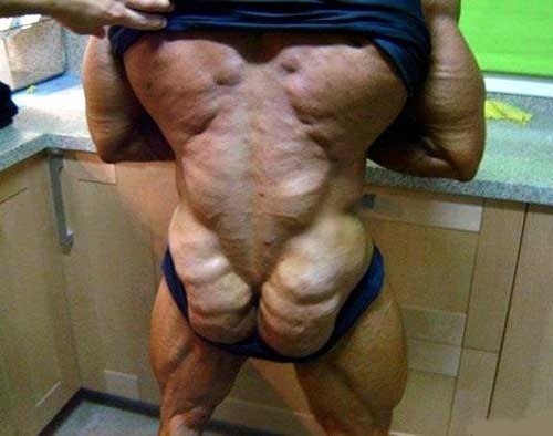 "Faceti ca mine si veti arata asa". Cum a ajuns sa arate un barbat dupa excesul de steroizi. FOTO