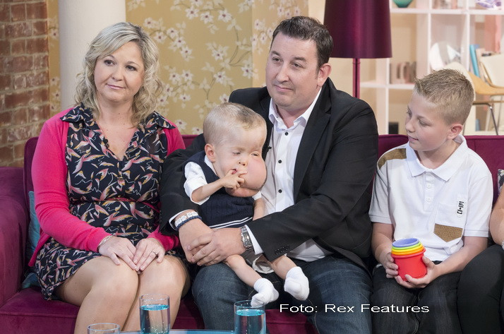 Cazul pe care niciun medic nu a reusit inca sa-l rezolve. Boala ciudata de care sufera acest copil