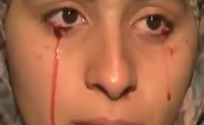 Oameni care cred ca sunt morti sau care plang cu lacrimi de sange. Top 3 afectiuni medicale bizare