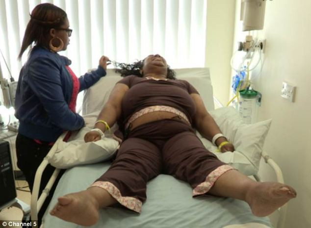 Cazul bizar ce i-a uimit pe doctorii britanici: femeia care se "transforma" in Incredibilul Hulk