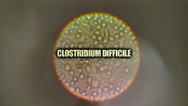 Focar de infectie la spitalul din Timisoara. Bacteria care a ucis un om se ia de pe clante si mobila