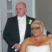 "Mi-a intrat un gandac in cap si mi-au taiat creierul". O femeie a supravietuit unei boli cumplite