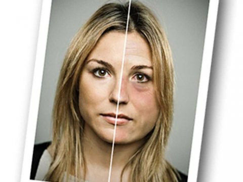 Ce detaliu a putut schimba in acest fel chipul tinerei din fotografie. Diferenta este surprinzatoare