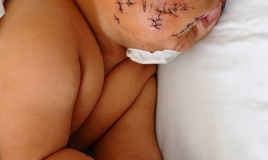 Imaginea in fata careia au plans MILIOANE de oameni: BEBELUS injunghiat de 90 de ori. Vezi aici FOTO