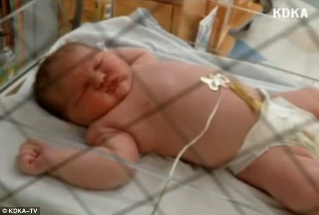 Medicii au fost uimiti cand au vazut cum arata bebelusul la nastere. "Nu am mai vazut asa ceva"