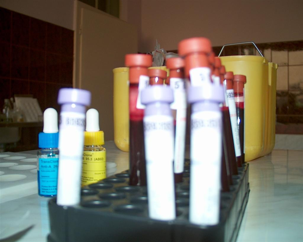 Aradenii sunt nevoiti sa-si plateasca analizele prescrise de medici. Fondurile au fost epuizate