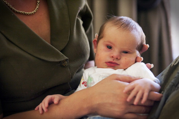 Primul pas catre un tratament pentru vindecarea sindromului Down