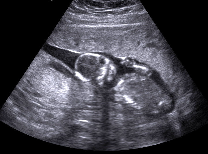 Femeia care a fost gravida timp de 12 ani. "Bebelusul numarul 17 o sa apara in aprilie"