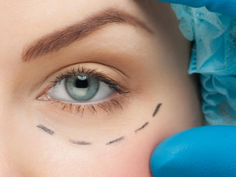 "Mi-a cazut fata, la propriu". Drama unei femei care a vrut doar sa scape de riduri si de pielea imbatranita