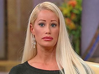 "Am fost obsedata de ele si acum le regret". Cum arata acum femeia, dupa 58 de operatii estetice