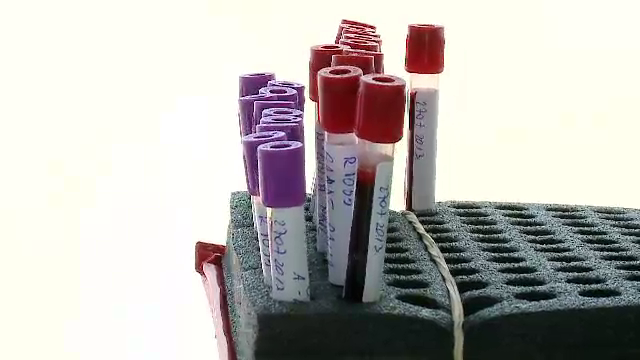 Eprubeta care ar putea salva o viata. Cat de usor puteti intra in Registrul National al Donatorilor