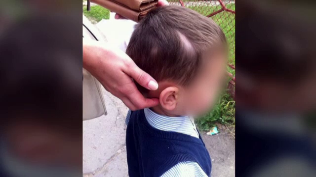 O asistenta medicala din Suceava, acuzata ca a agresat un copil la cresa: "I-a smuls parul din cap"