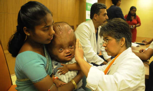 Roona Begum, fetita a carei poveste a facut inconjurul lumii, a iesit din spital dupa 4 luni