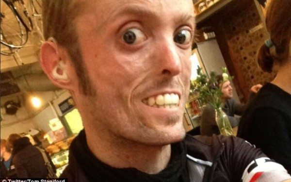 "Are o boala foarte rara, dar suntem un cuplu normal" . Barbatul care nu se poate ingrasa deloc