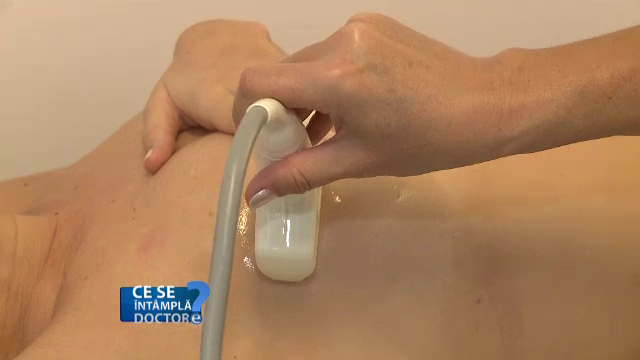 Situatia in care medici recomanda extirparea ambilor sani in cazul femeilor bolnave de cancer