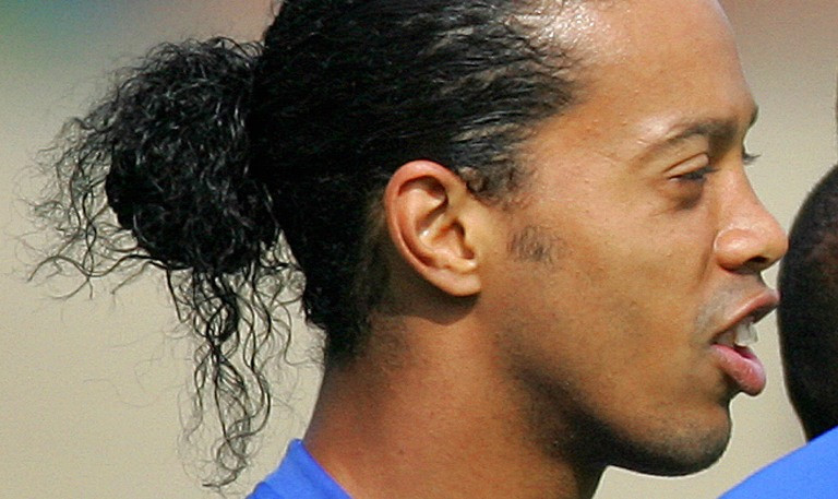 Ronaldinho a fost supus unei operatii de remodelare a gingiilor si dintilor