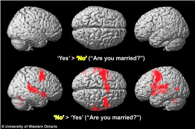 Tehnologia miraculoasa ca l-a ajutat pe un pacient aflat de 14 ani in coma sa vorbeasca cu medicii