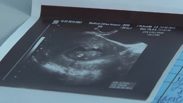 Politistii au deschis dosar penal pentru neglijenta in serviciu in cazul bebelusului nascut infirm