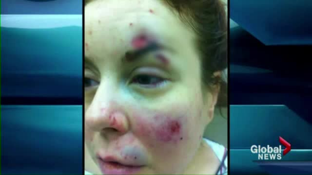 O doctorita de origine romana sustine ca a fost batuta fara motiv de politia din Canada. FOTO