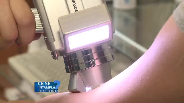 Persoanele cu piele alba, mai expuse riscului de cancer cutanat. Cum poate fi prevenita afectiunea