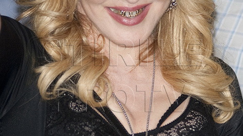 Imaginea care i-a speriat pe fani. Cum a aparut in public o super vedeta