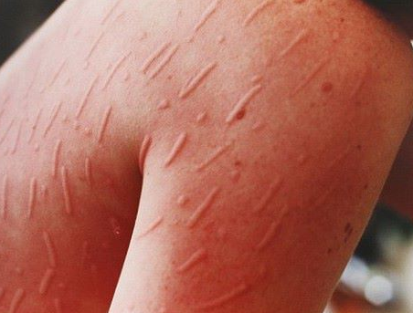 Absolut IMPRESIONANT! Iata ce poate sa faca o TANARA cu propria PIELE