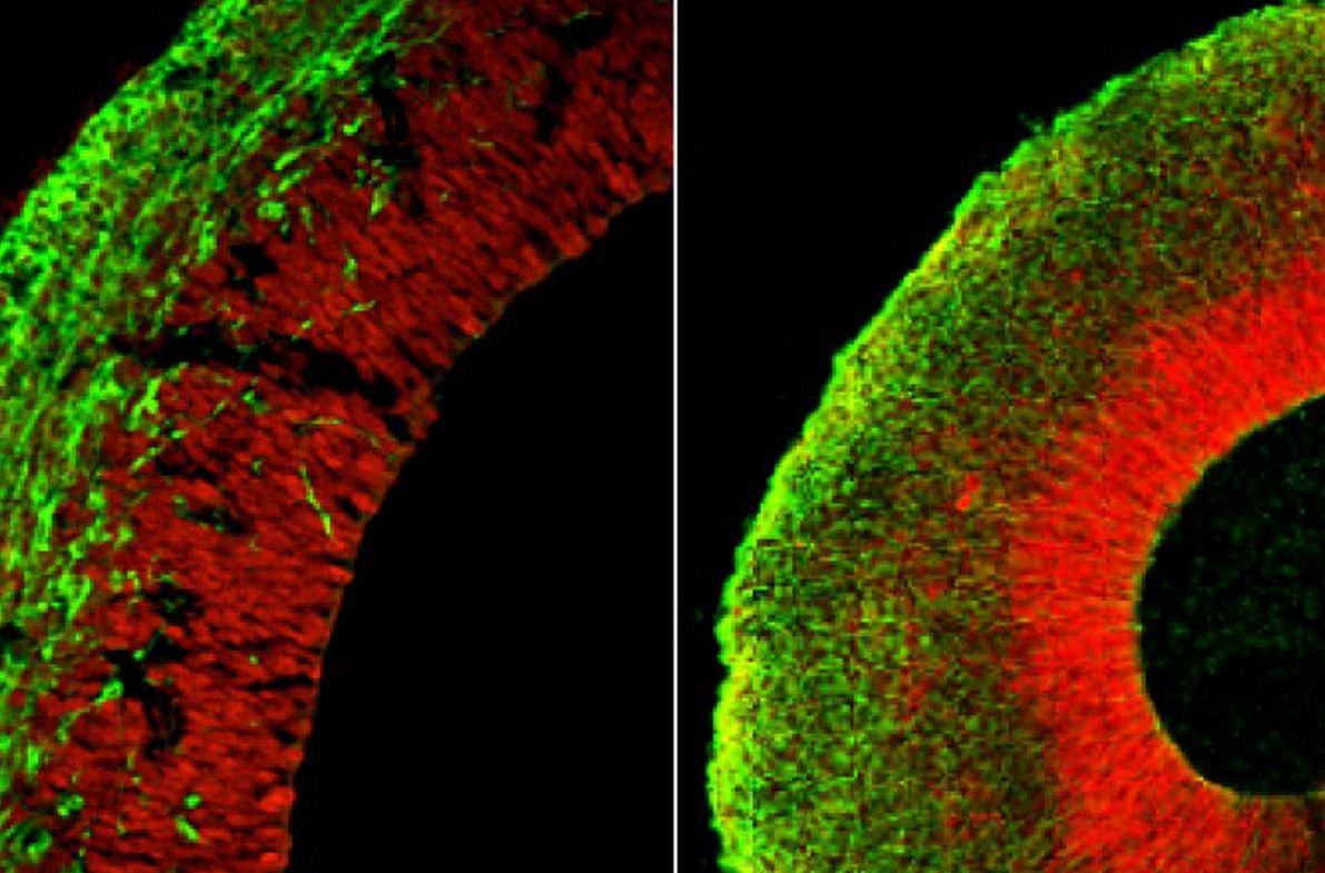 Premiera care poate schimba viitorul medicinei. Oamenii de stiinta au "crescut" un micro creier