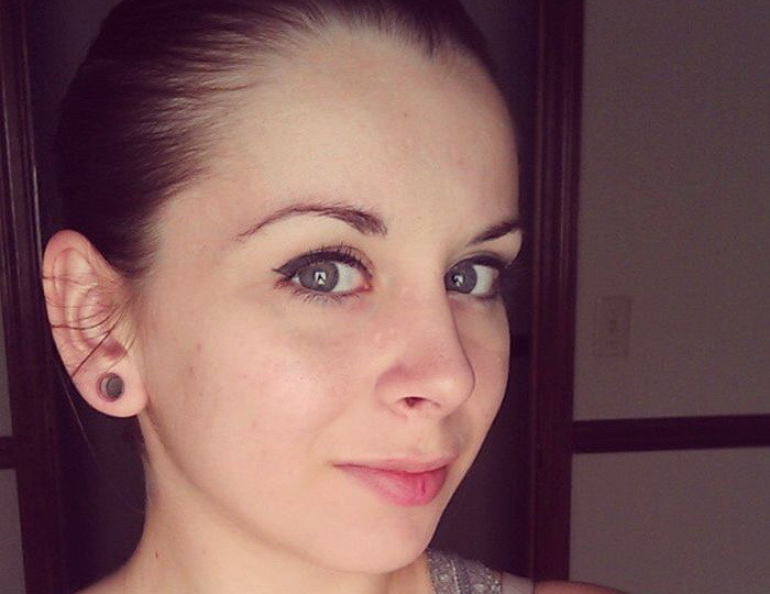 Ce se intampla cand faci o boala a copilariei la 21 de ani. GALERIE FOTO