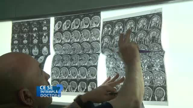 Mergeti la medic daca v-ati lovit la cap. Specialistii va spun ce riscati in astfel de situatii