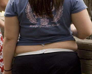 Studiu. Oamenii de stiinta au descoperit bacteria cauzatoare de obezitate