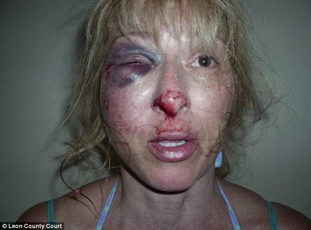 Imagini socante. A fost batuta cu bestialitate de politisti pentru ca a intrebat unde e sotul ei