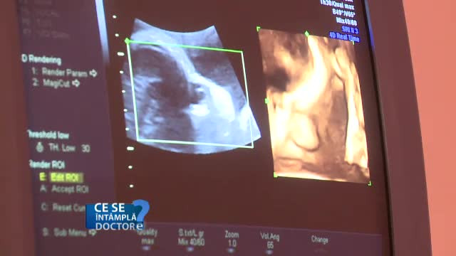 Beneficiile tehnologiei moderne. Cum salveaza medicii viata bebelusilor chiar in mediul intrauterin