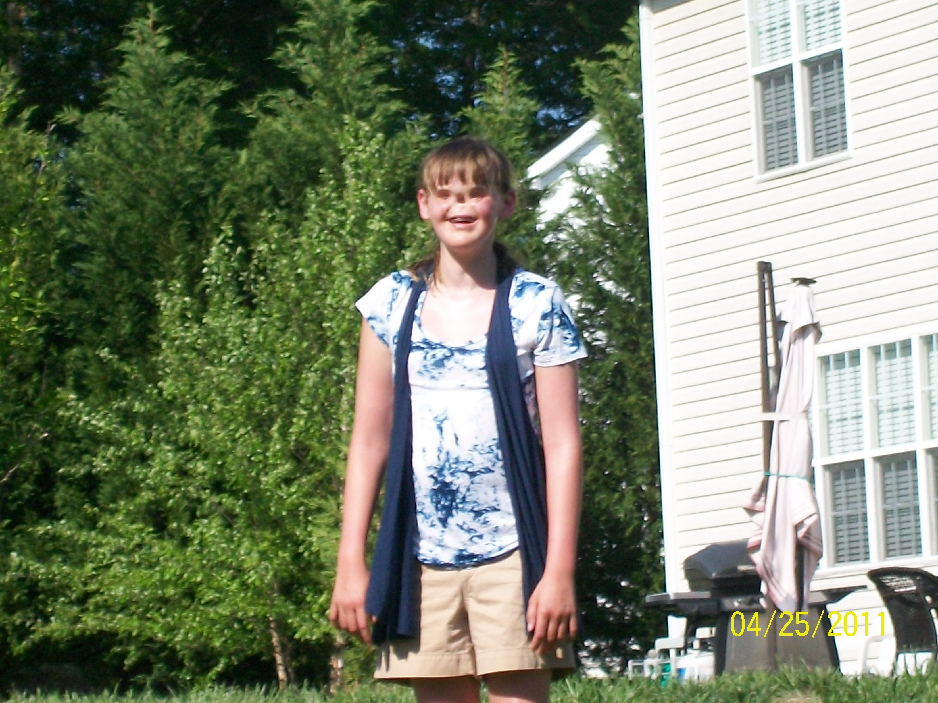 Cum arata dupa 12 operatii fata care s-a nascut fara ochi si nas. FOTO