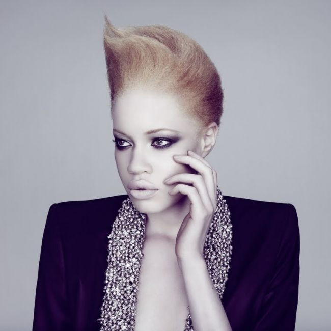 In copilarie a fost ridiculizata, acum e super model. Primul manechin femeie afro-american albinos