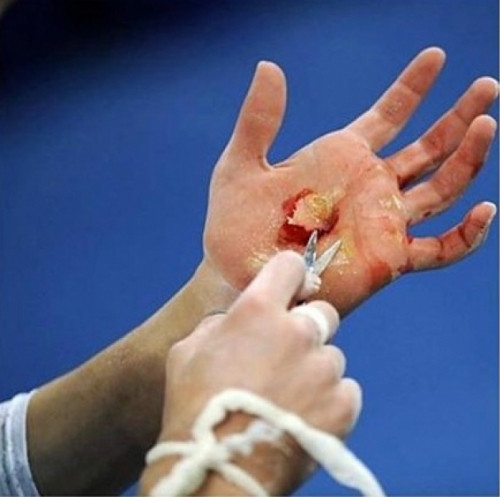 Cum arata palma unei campioane la gimnastica. Poza publicata pe Facebook de Silvia Stroescu