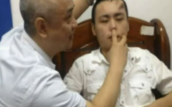 Medicii chinezi i-au crescut unui pacient un nas nou pe frunte