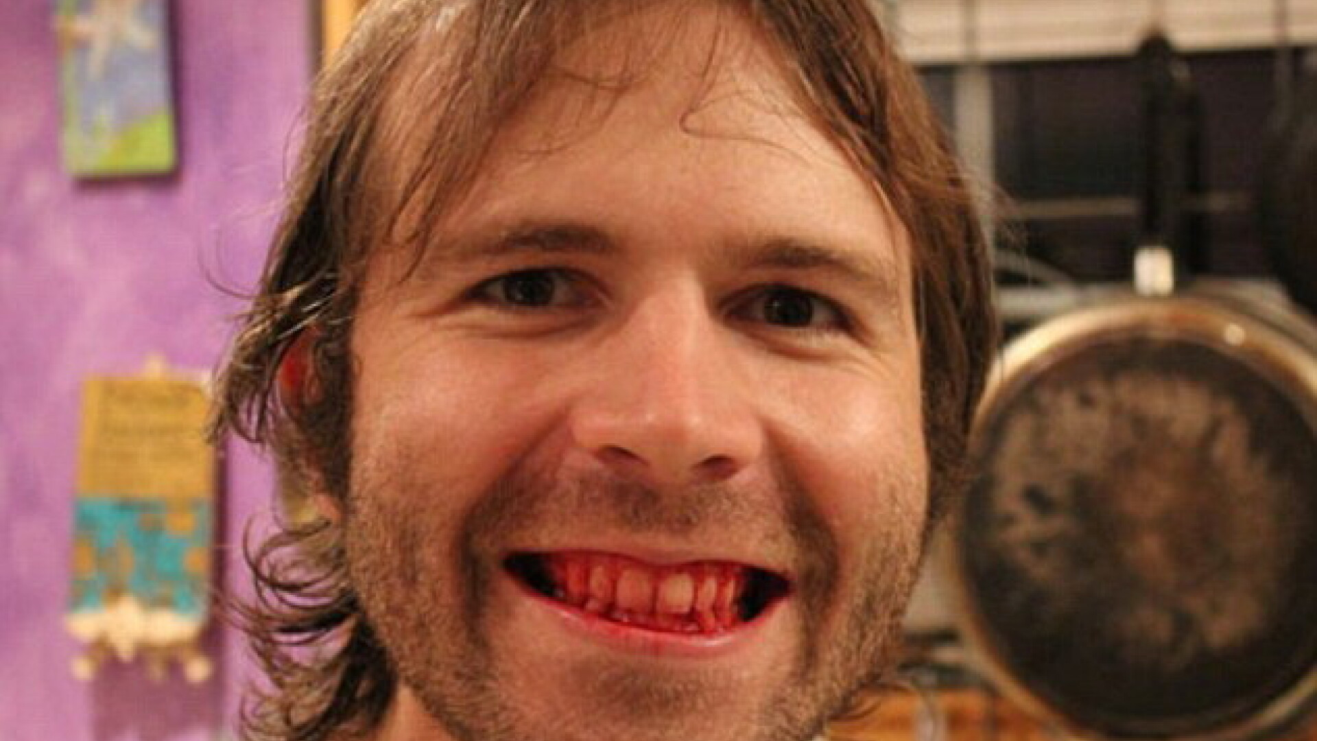 "Sunt un ciudat, dar doar asa pot trai". Cum arata barbatul care de 5 ani mananca numai carne cruda