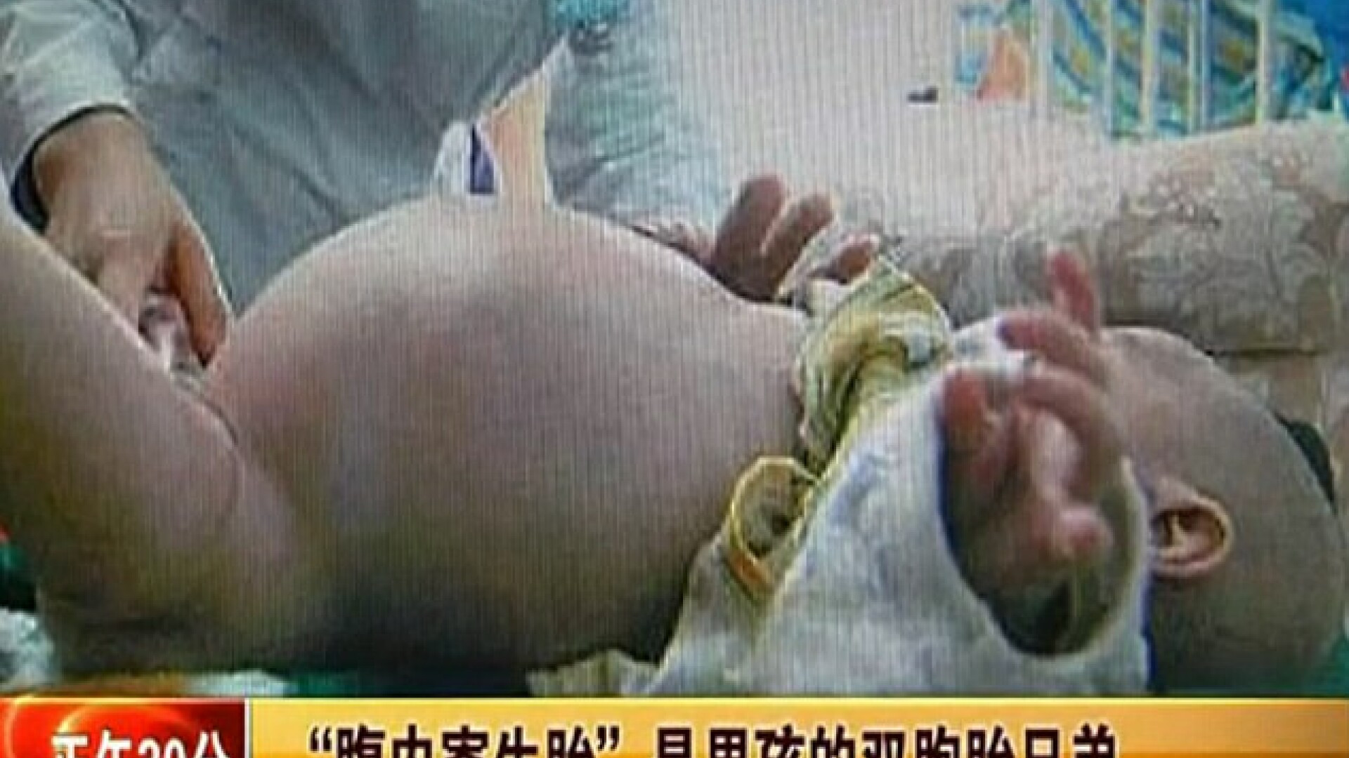 China gravid