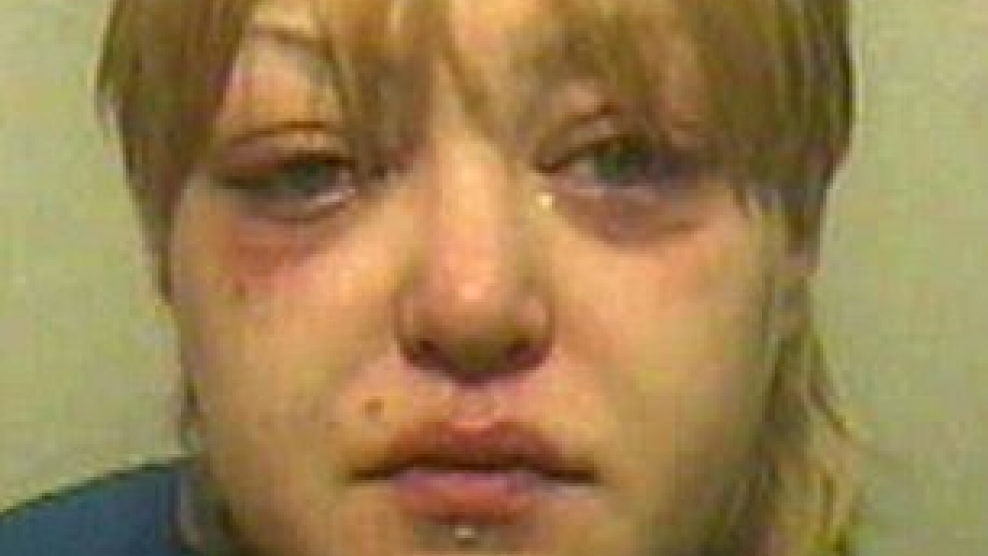 Cum s-a transformat aceasta femeie, dupa ce a consumat timp de 5 luni cate 2 sticle de alcool pe zi